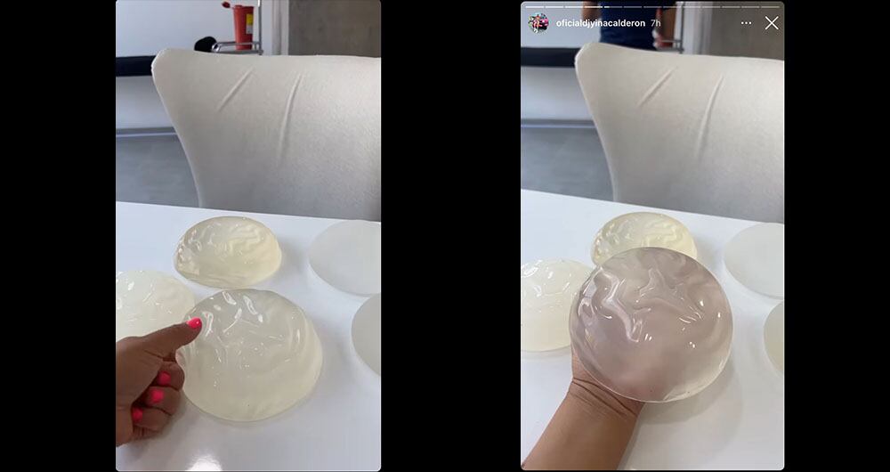 Prótesis que usará Yina Calderón - Foto tomada de Instagram @oficialdjyinacalderon