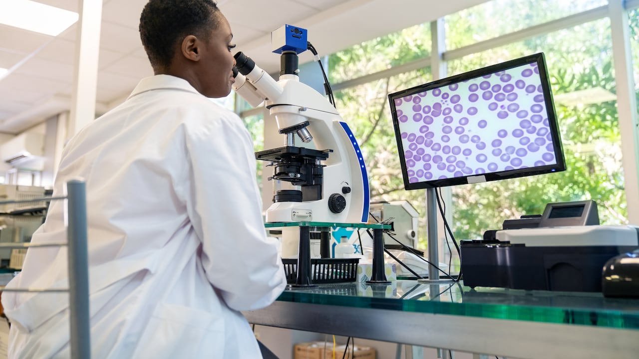 Las células CAR T se reprograman y se concentran en atacar específicamente el tumor.