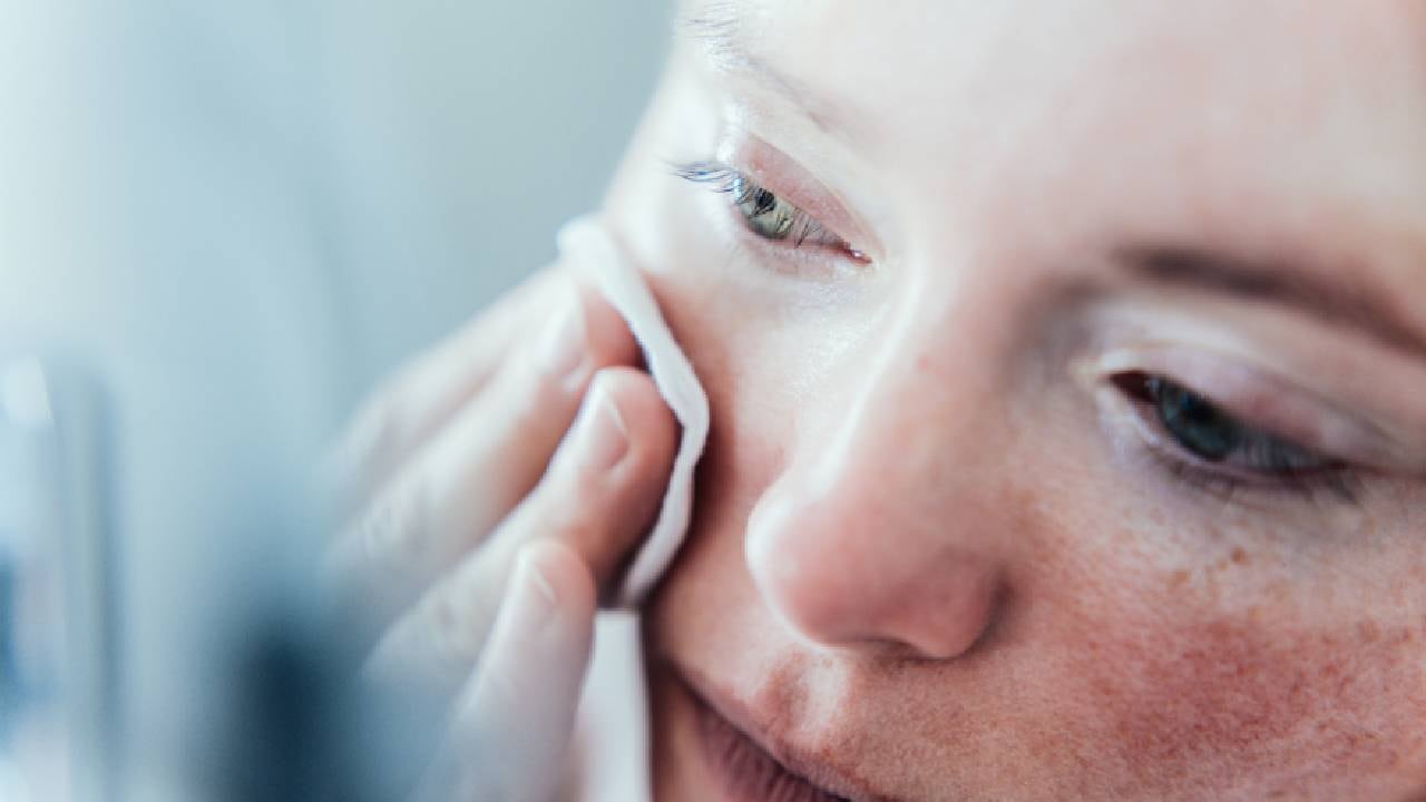 Las pequeñas pústulas o granos aparecen en brotes, sobre todo en las mejillas.