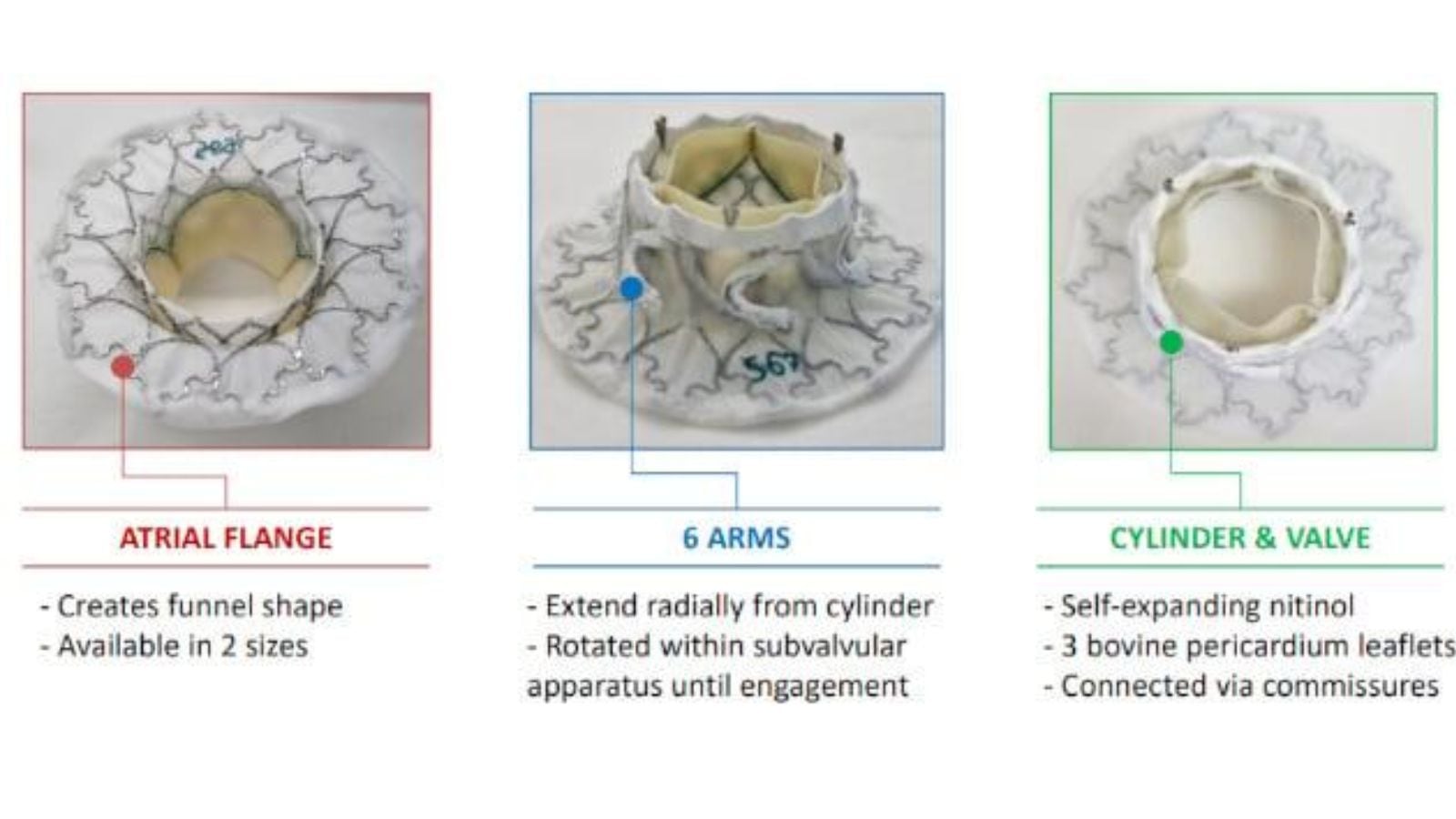 El sistema de reemplazo de válvula mitral de Innovalve está compuesto por diferentes elementos diseñados para fijar la prótesis y permitir el funcionamiento de la nueva válvula.