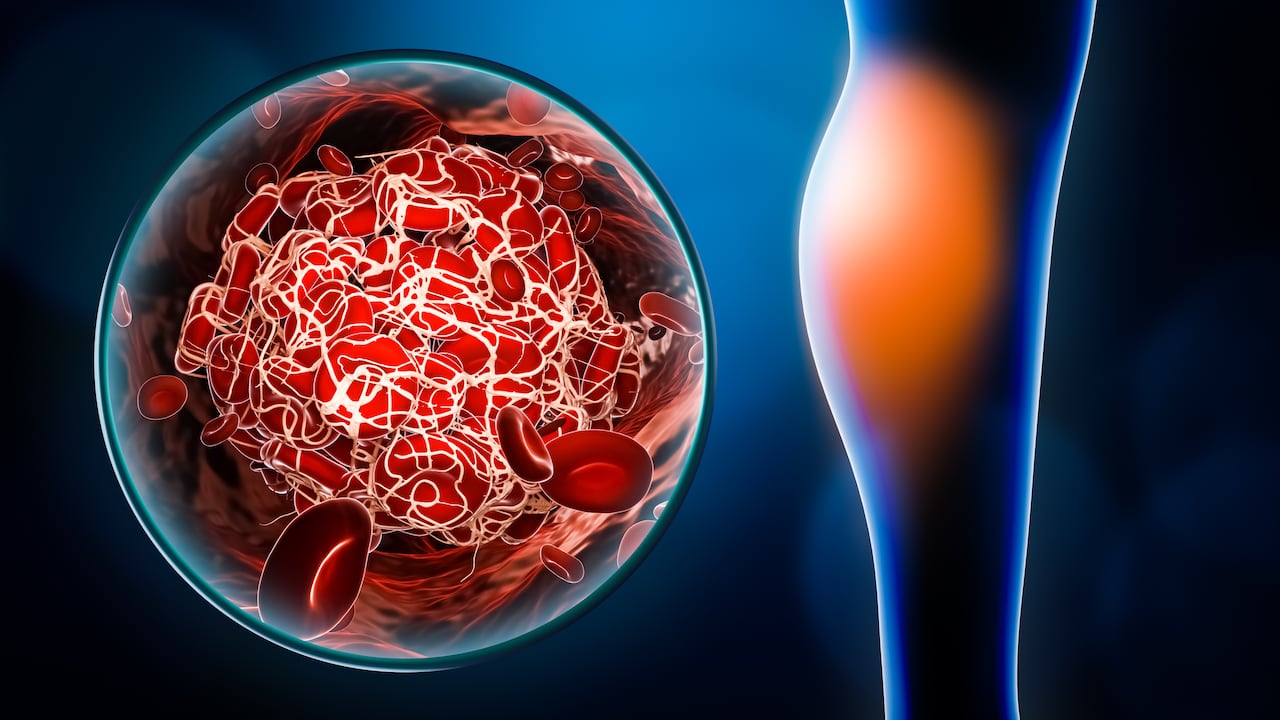 Una buena alimentación es necesaria para mantener el organismo en buen estado y prevenir la mala circulación sanguínea.
