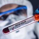 OPS asegura que América es el continente con más médicos infectados por covid-19