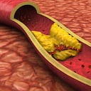 Expertos señalan que los jugos de frutas naturales son excelentes aliados para ayudar a bajar el colesterol LDL "malo". Foto: Getty Images.