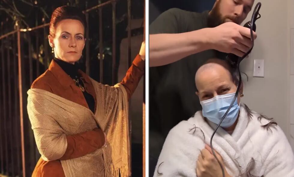 La actriz de Pasión de Gavilanes ha conmovido a todos sus seguidores, luego de mostrar en redes su proceso con esta grave enfermedad.