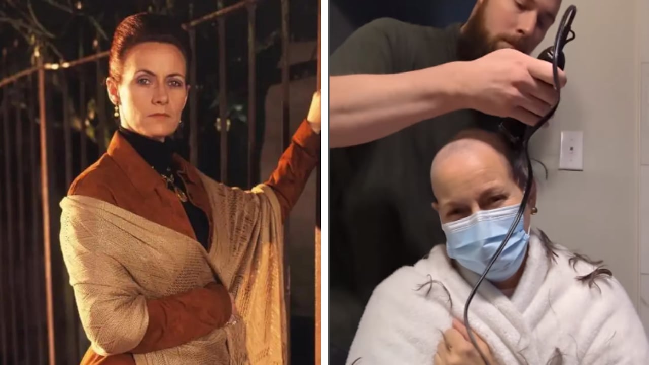 La actriz de Pasión de Gavilanes ha conmovido a todos sus seguidores, luego de mostrar en redes su proceso con esta grave enfermedad.