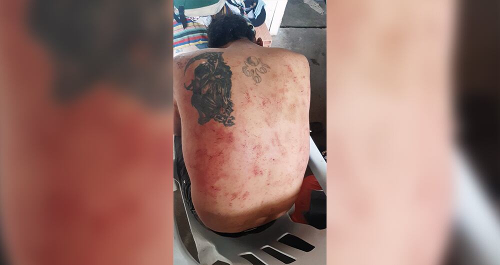 Muerte y tortura en un operativo_6