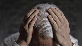 La falta de melanina genera la aparición de las canas en la juventud. Foto GettyImages.