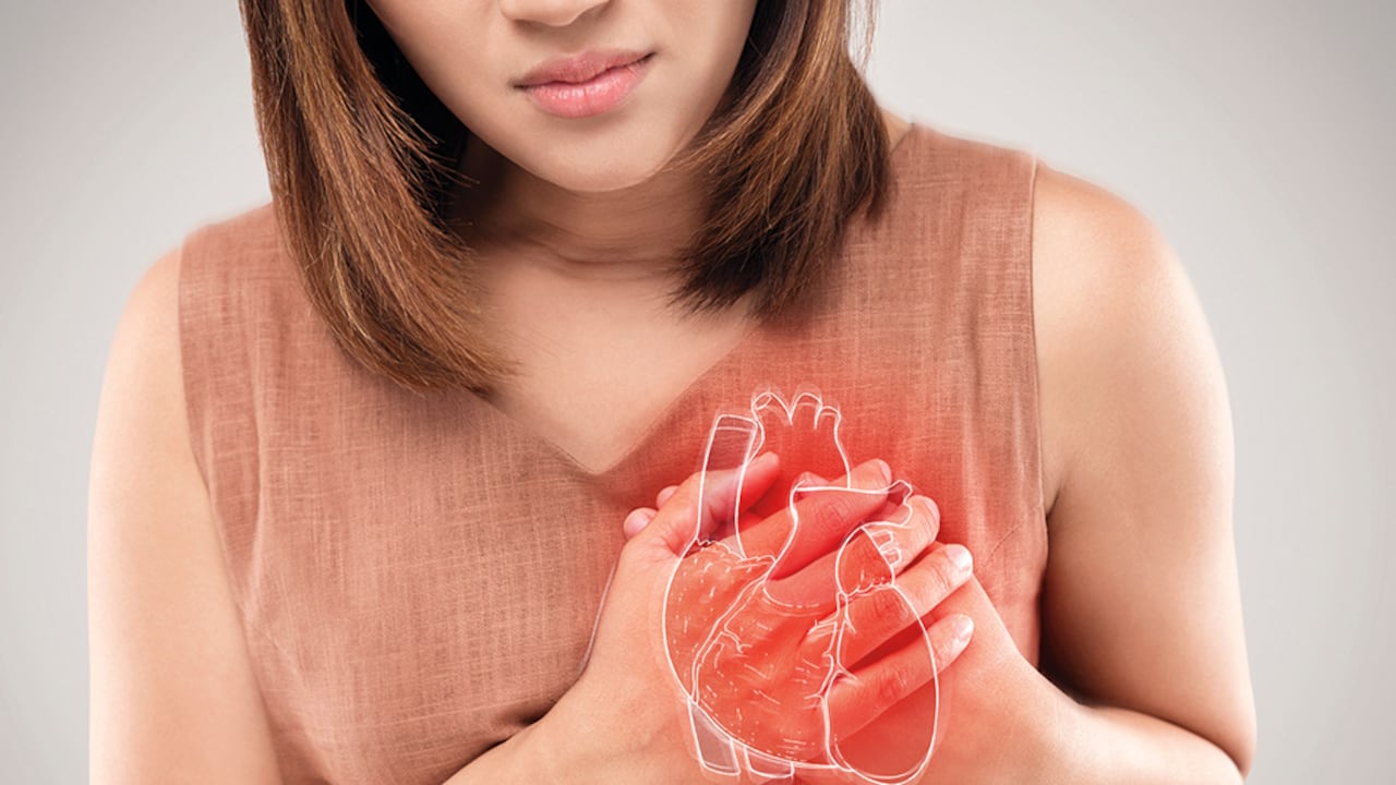 Si una arteria resulta obstruida, esto puede llevar a que se presente un ataque cardíaco o un accidente cerebrovascular.