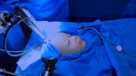 Coelho ideó este bebé simulador cuando era residente de cuarto año y se enfrentaba al miedo de operar cerebros diminutos sin la suficiente práctica previa.