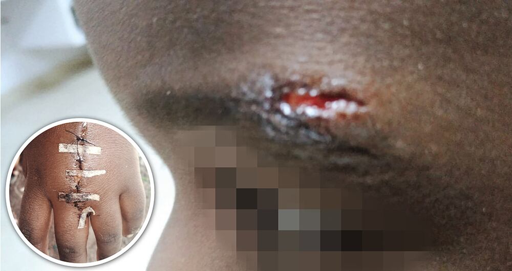 Violencia racista en Boyacá_2