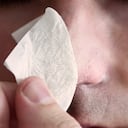 Lo que más se recomienda es consultar con especialistas para el tratamiento de los puntos negros. Foto: Getty Images.