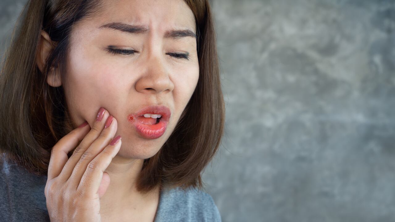 Las principales causas de las boqueras son la exposición al frío y aire muy caliente, la falta de líquidos y un sistema inmunitario debilitado.