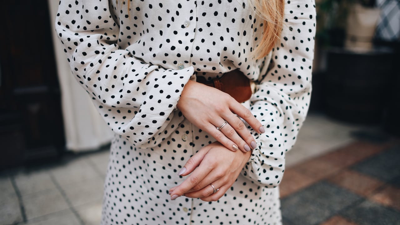 Lunares en las manos