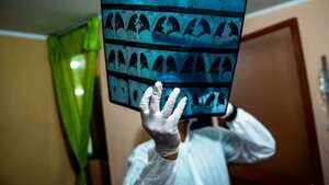 El estudio de personas que muestran niveles inusuales de resistencia o susceptibilidad al covid-19 puede conducir a nuevos tratamientos. BBC - GETTY