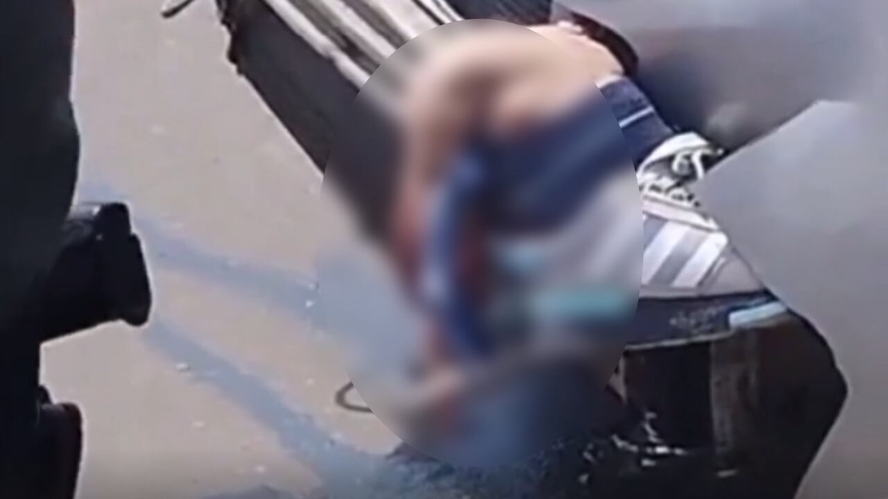 Momento en que un motociclista pierde una pierna tras chocar con un carro; las imágenes son escalofriantes