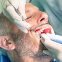 Los cálculos en los dientes aparecen como consecuencia de una mala higiene bucal.