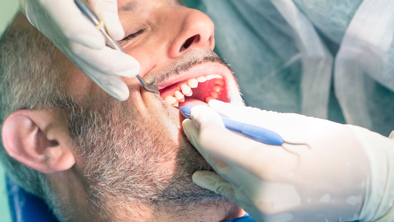 Producto puede acabar con el molesto sarro de los dientes.