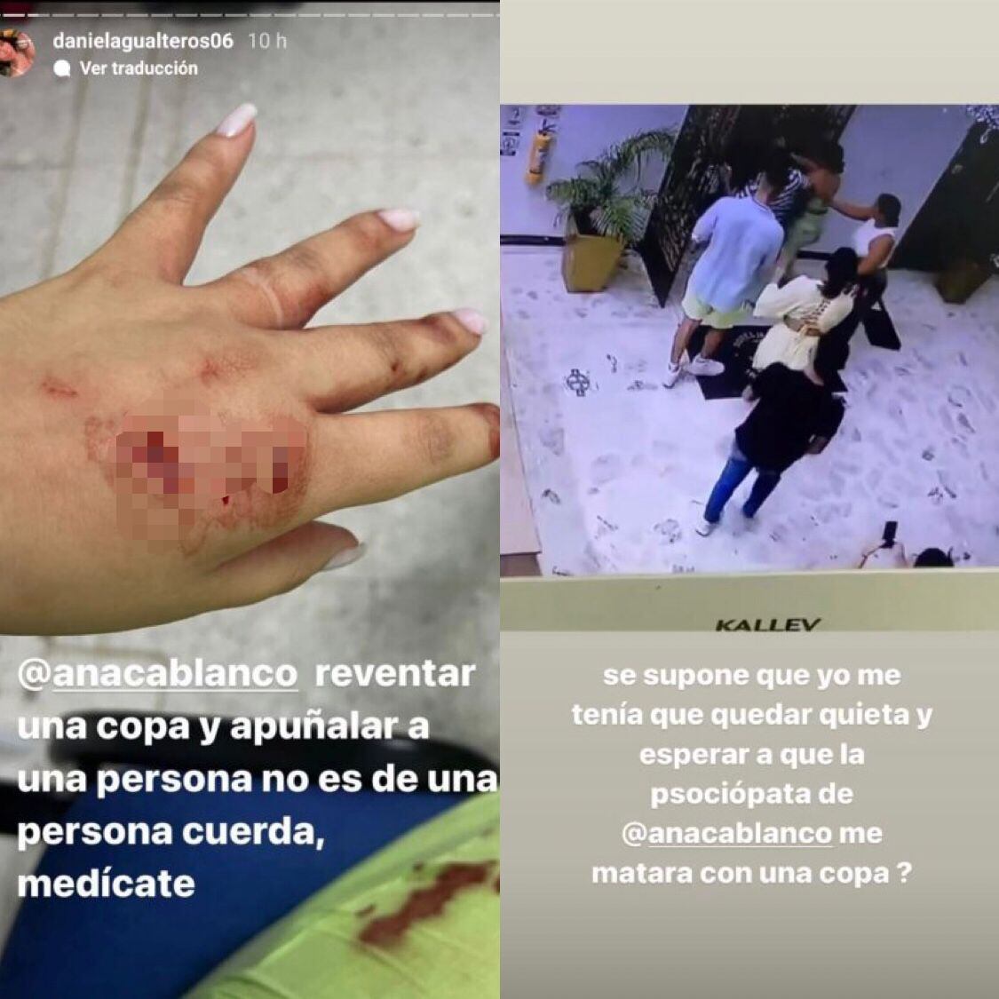 Captura de las historias de Daniela Gualteros, donde muestra las consecuencias del altercado.