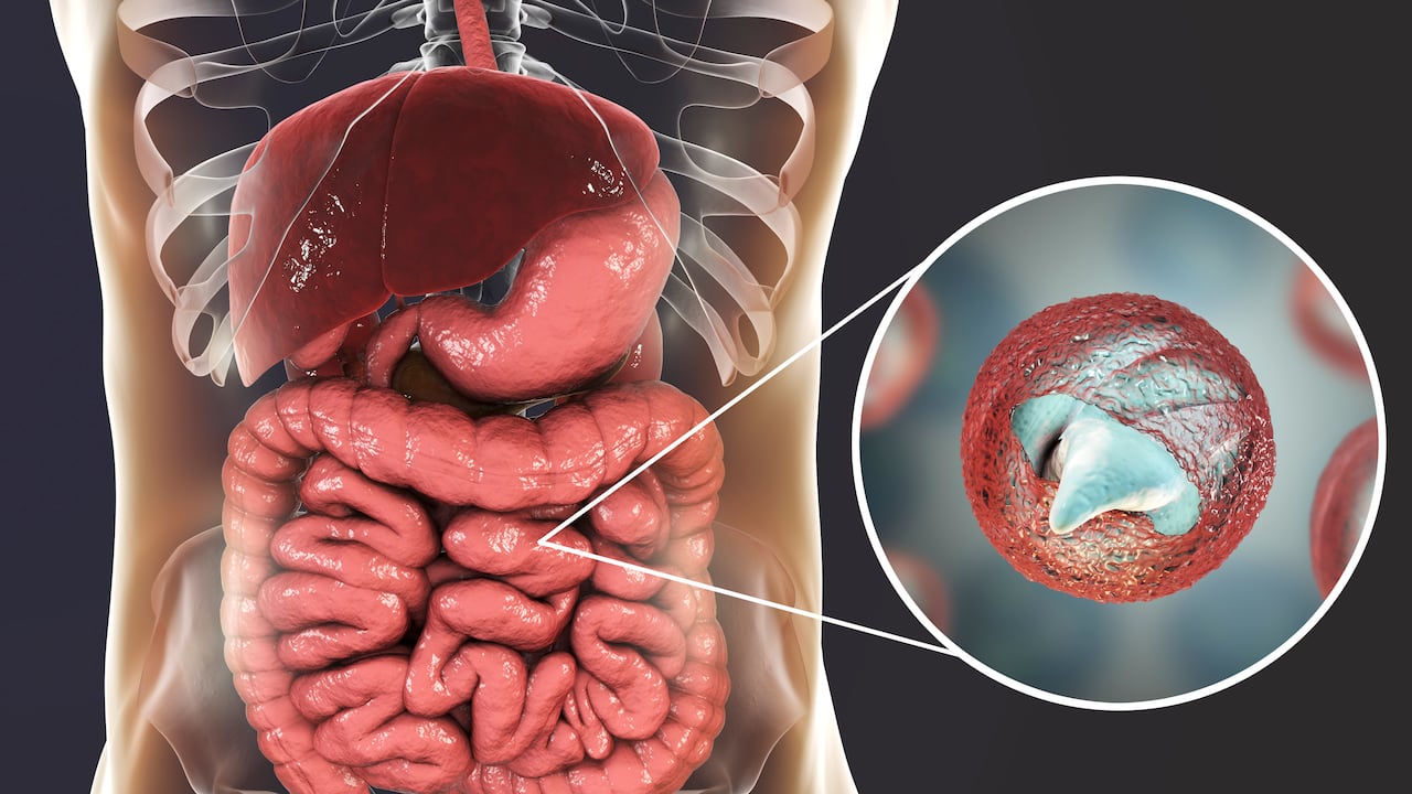 Estos parásitos aparecen tras el consumo de alimentos contaminados.
