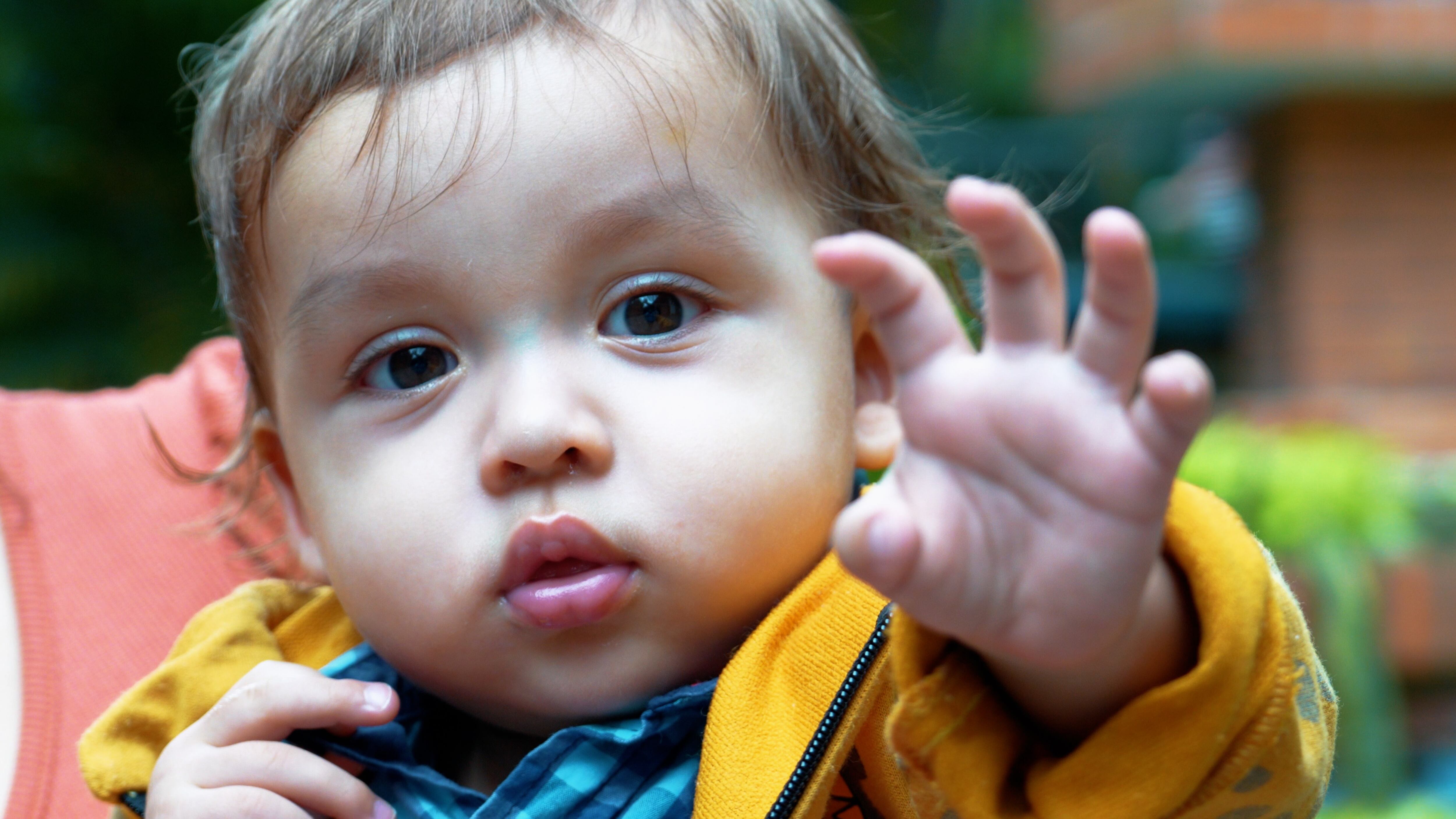 Pablo será sometido a su tercer cirugía cuando cumpla tres años.