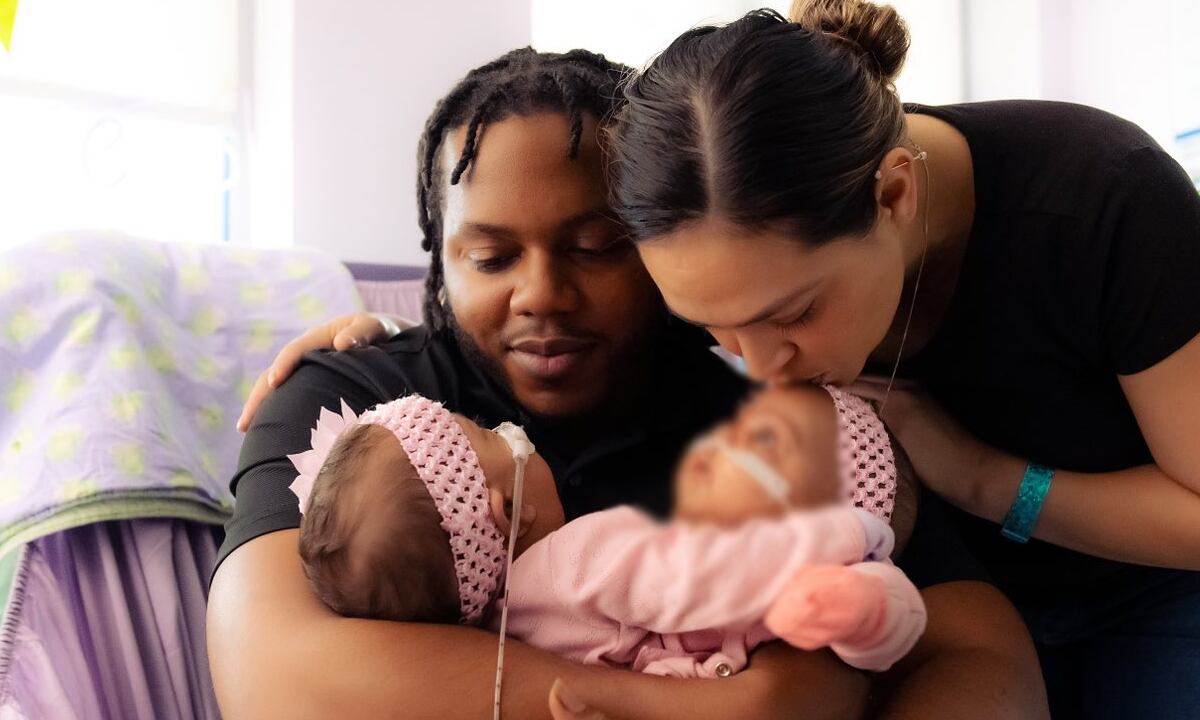 Amie Lynn y Jamie Lynn Finley, junto a sus padres. la cirugía para separarlas fue un éxito.