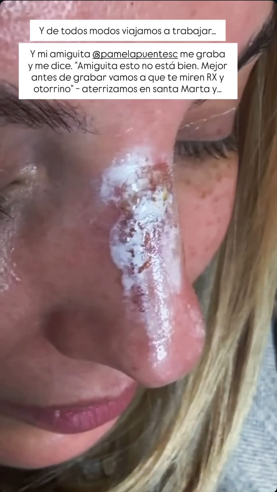 Así quedó el rostro de la presentadora.