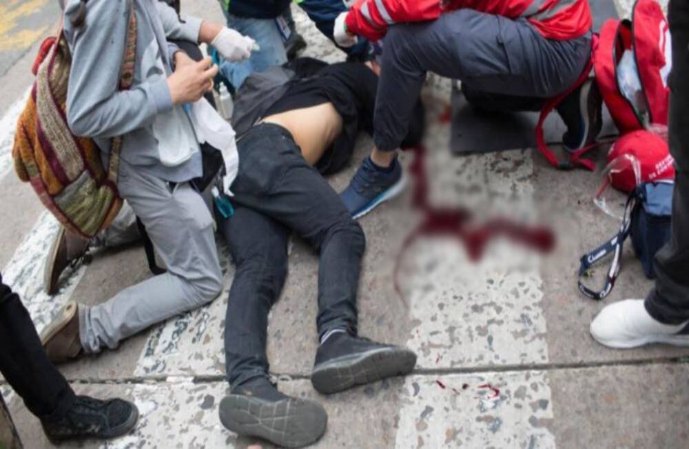 Dilan cayó sobre el asfalto tras el impacto que sufrió en la cabeza. Amigos y transeúntes lo socorrieron y varios de ellos denunciaron demoras en la respuesta de los organismos de salud para trasladarlo a un centro médico. Foto: Mauricio Morales.