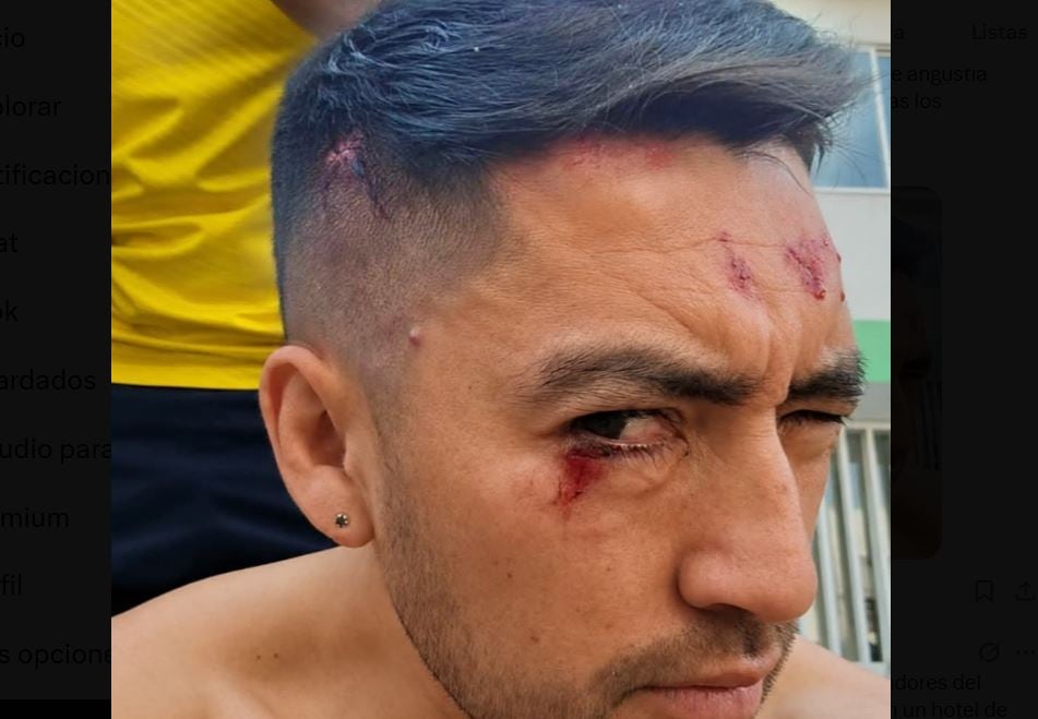 Carlos Daniel Hidalgo, técnico de la Sub 17 del Deportivo Pasto, sufrió los rigores del terremoto en un hotel de Cali.