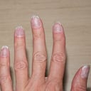 Las uñas frágiles y quebradizas pueden presentarse por una mala alimentación o alguna enfermedad.