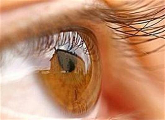 La pérdida de visión corresponde a una afectación en la retina. 