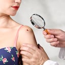 La pesadilla de la mujer comenzó después de que un médicos sospechara que tenía cáncer por un lunar en uno de sus brazos.