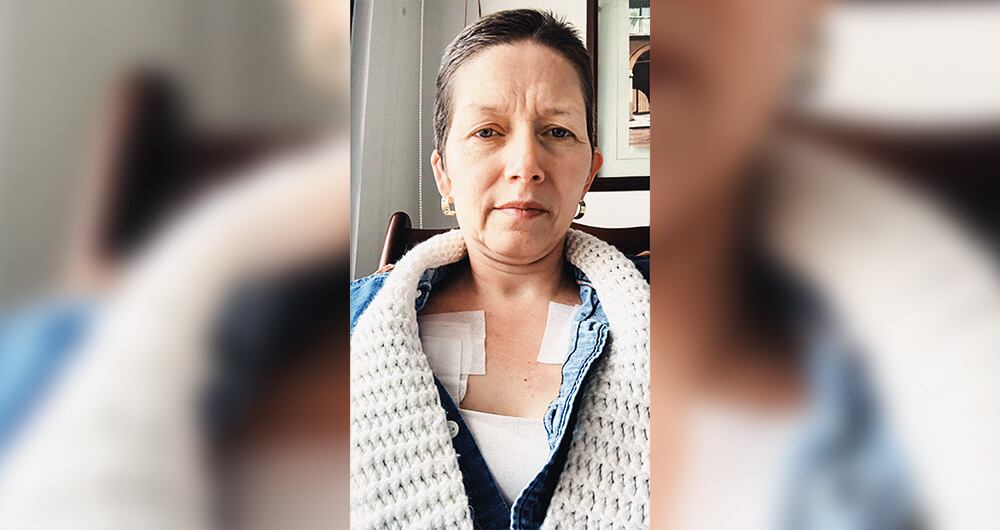    Cada 21 días se enfrenta a este tratamiento oncológico.