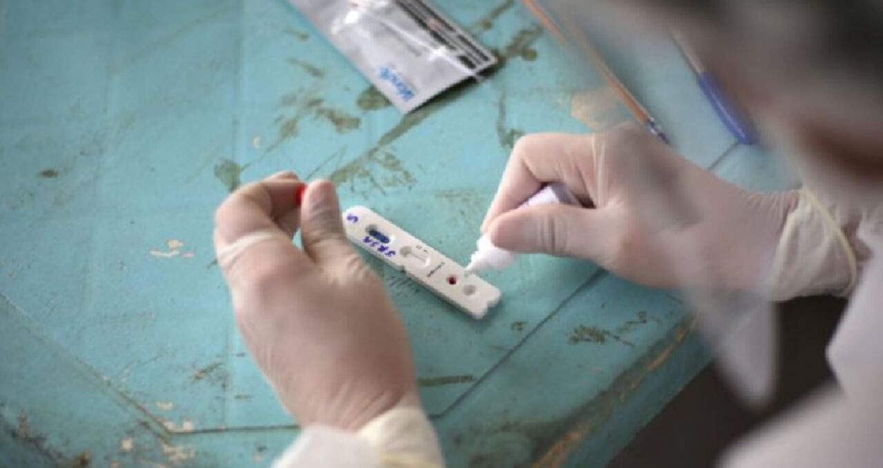La investigación sobre la nueva variante se hizo con 31 muestras de pacientes con covid-19 en la capital de Amazonas.
