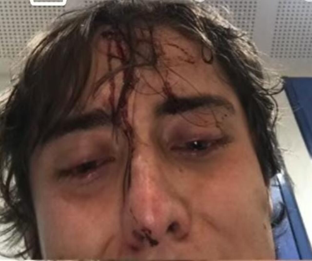 El joven fue golpeado en la localidad de Usaquen