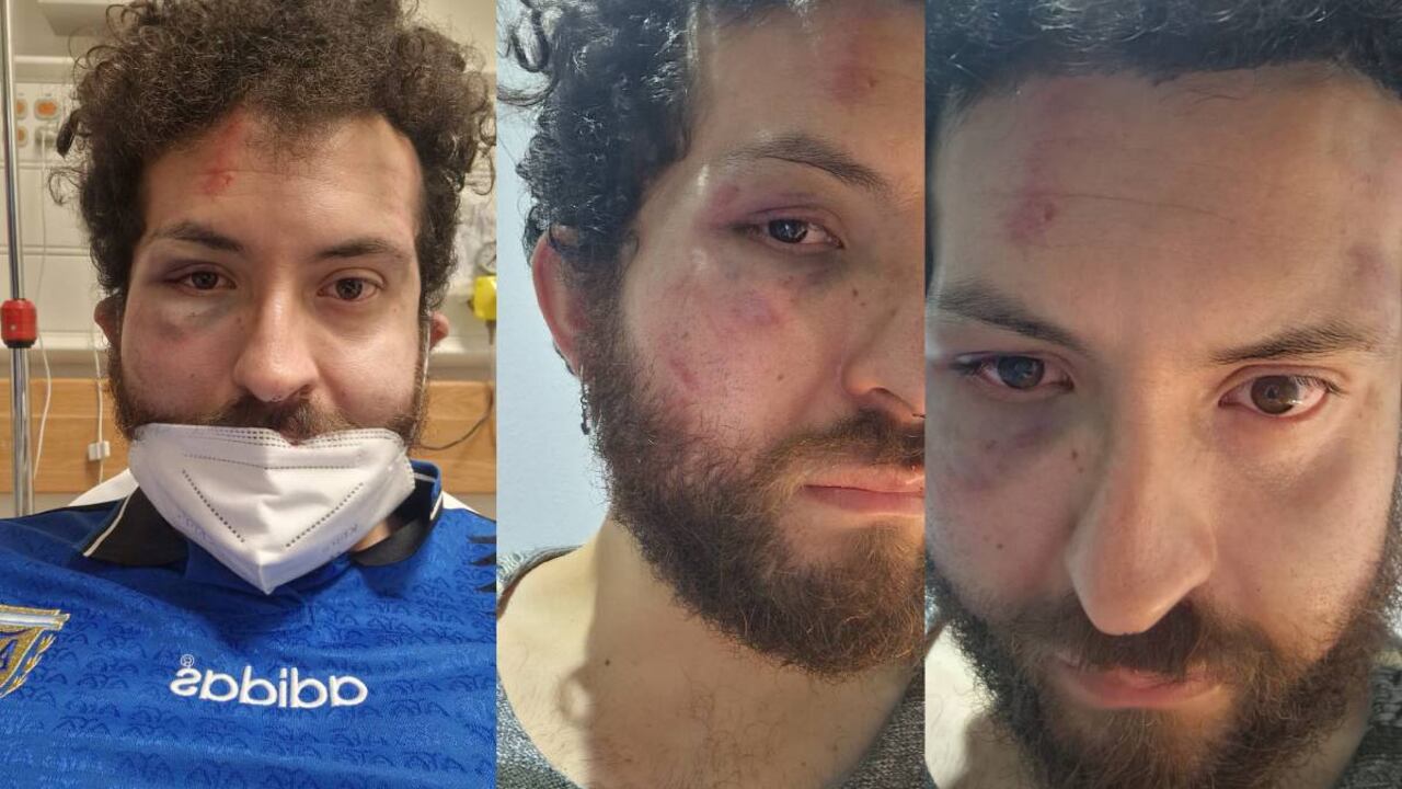 Algunos testigos aseguran que fueron varios guardas de seguridad de otros bares que agredían fisicamente al colombiano