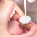 La limpieza dental profesional parece reducir el crecimiento bacteriano que causa inflamación y que puede conducir a enfermedad del corazón y ECV. (Foto: Thinkstock)