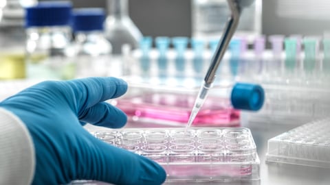 El diagnóstico temprano de estas patologías puede prevenir que avancen de manera rápida.