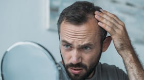 Hombre envejecido medio molesto con alopecia mirando en el espejo, concepto de pérdida de cabello. Calvicie.