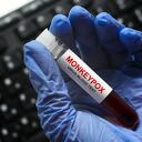 Viruela símica en Colombia