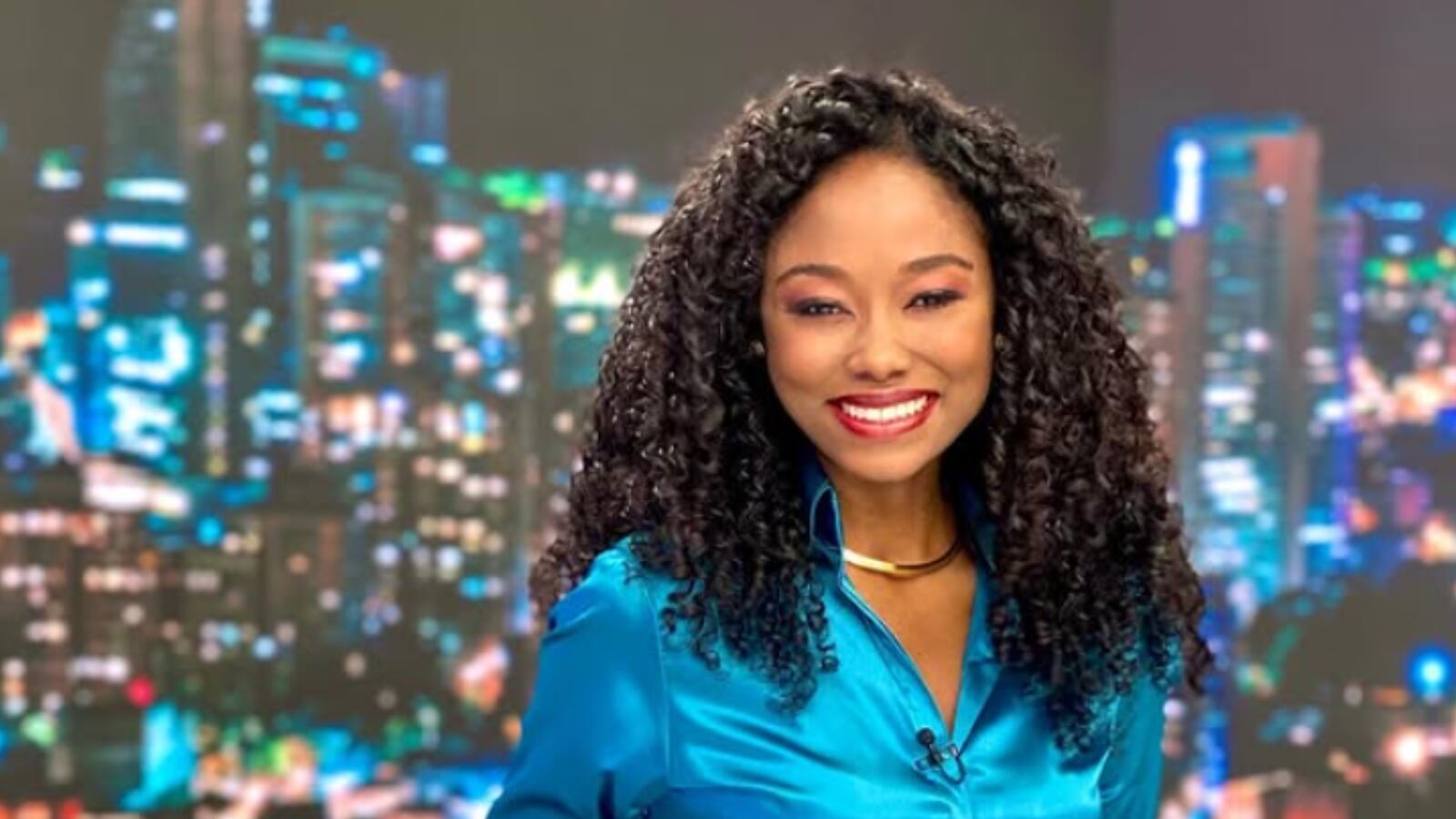 Rossy Lemos confiesa cuál fue la cirugía a la que se sometió antes de hacer parte del equipo de RCN