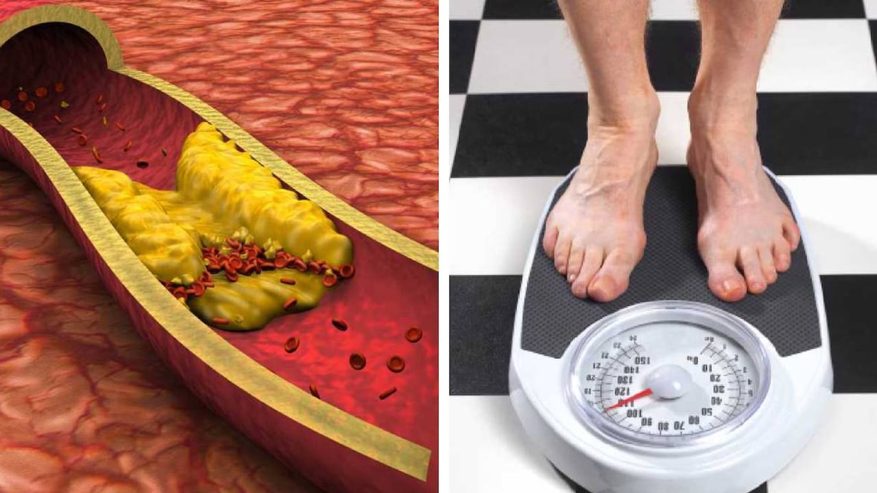 Expertos en Japón señalan que la vitamina E ayuda a la reducción del colesterol malo. Foto: Getty images montaje SEMANA.