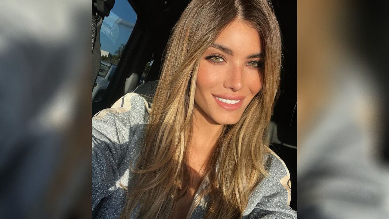 La expareja del artista urbano compartió imágenes del problema de salud que atraviesa. Foto: Instagram @aleskagenesis