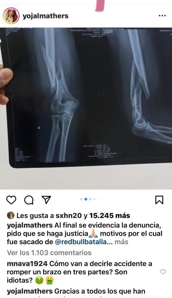 William Daniel Martín Martínez, conocido como Carpediem y campeón colombiano de freestyle, tenía asegurada su participación en la Final Internacional, donde competiría contra otros 15 representantes de diferentes países el sábado 2 de diciembre en Bogotá, su ciudad natal.