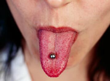 Las perforaciones en la boca pueden causar la formación de bacterias 