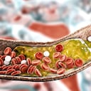 El colesterol cuando se adhiere a las arterias evita el flujo óptimo de la sangre.