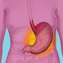 La gastritis es un grupo de enfermedades que tienen en común la inflamación del revestimiento del estómago, que se produce por la misma infección bacteriana y que es causada por la mayoría de las úlceras estomacales, el uso habitual de ciertos analgésicos e incluso por ingerir bebidas alcohólicas. (Photo By BSIP/UIG Via Getty Images)