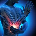 El codo de tenista puede general incapacidades y afectar la vida cotidiana.