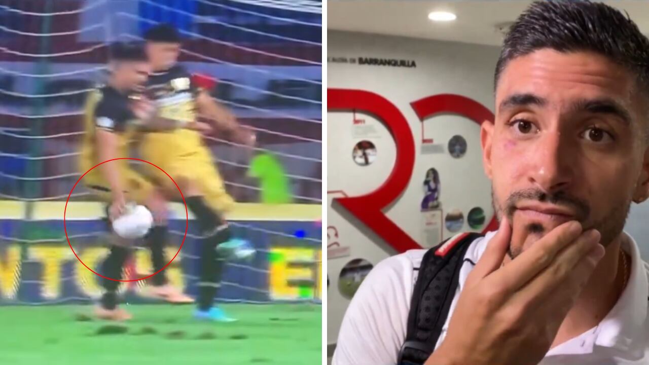 Mano Guillermo Celis ante Junior en Barranquilla.