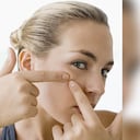 Expertos afirman que el consumo de grasas, lácteos y alimentos con altos niveles de azúcar puede generar la aparición del acné. Foto: GettyImages.