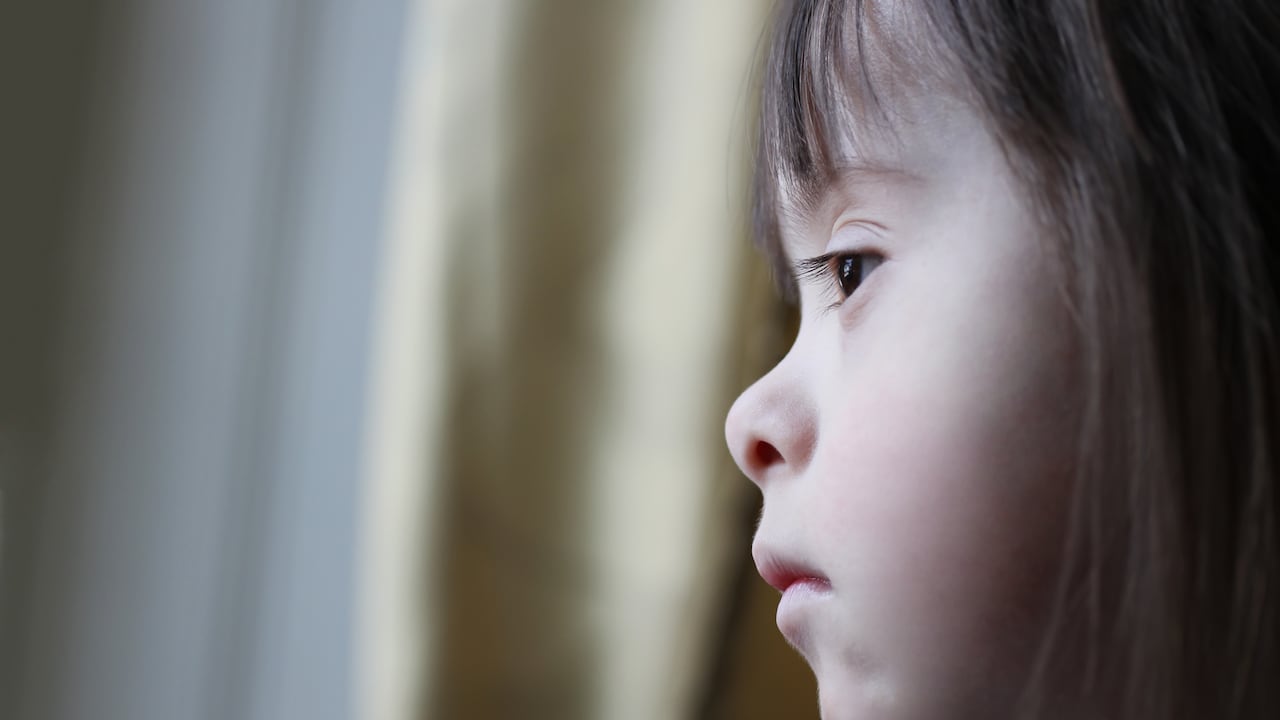 Niña con síndrome de down triste.